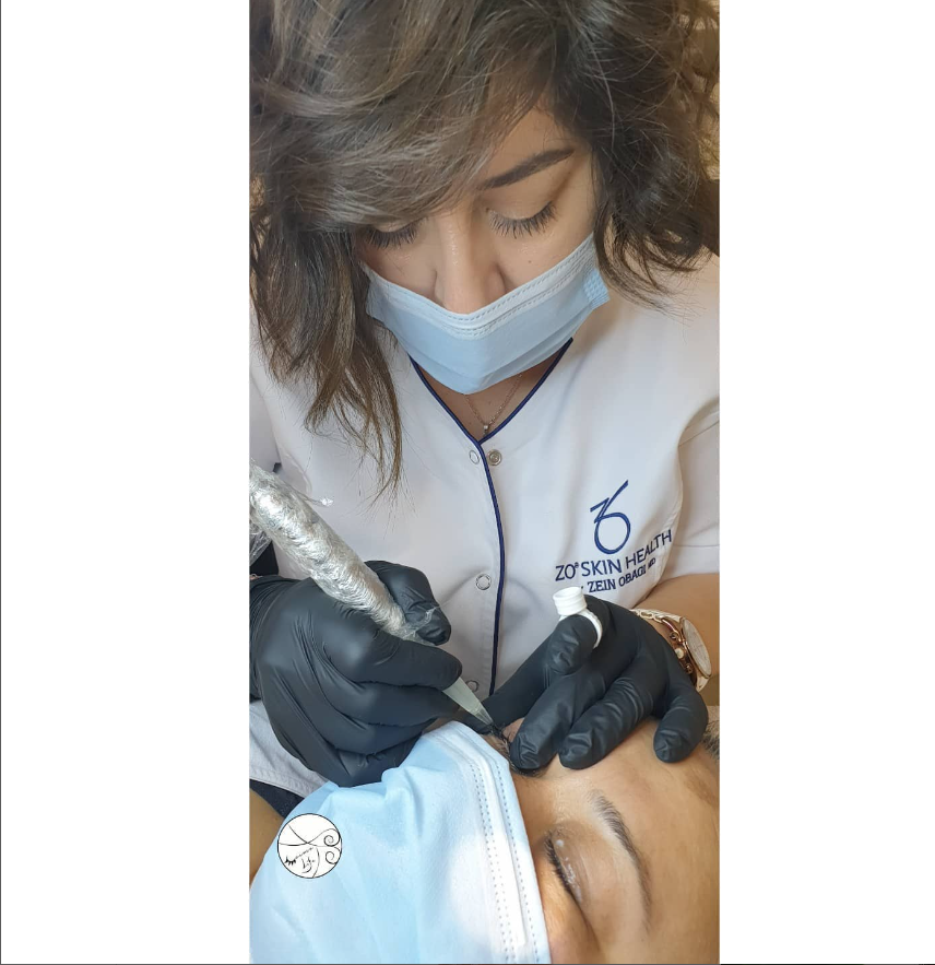 Maske ve eldiven takan bir uzmanın, ZO Skin Health üniformasıyla kaş bölgesinde mikroblading işlemi uyguladığı an. İşlem sırasında hasta da maske takmakta ve gözleri kapalı şekilde uzanmakta.
